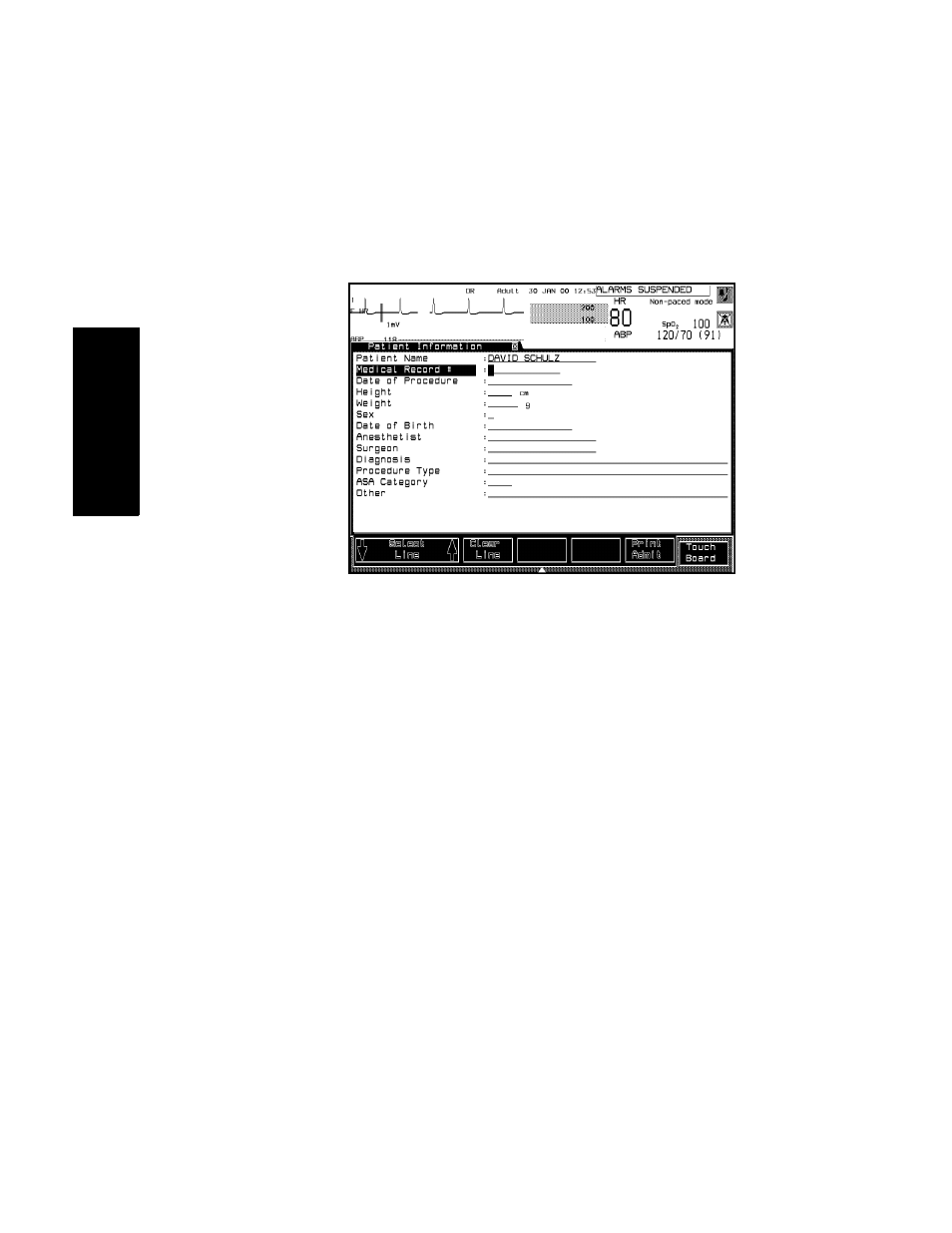 Philips V24CT User Manual | Page 236 / 392
