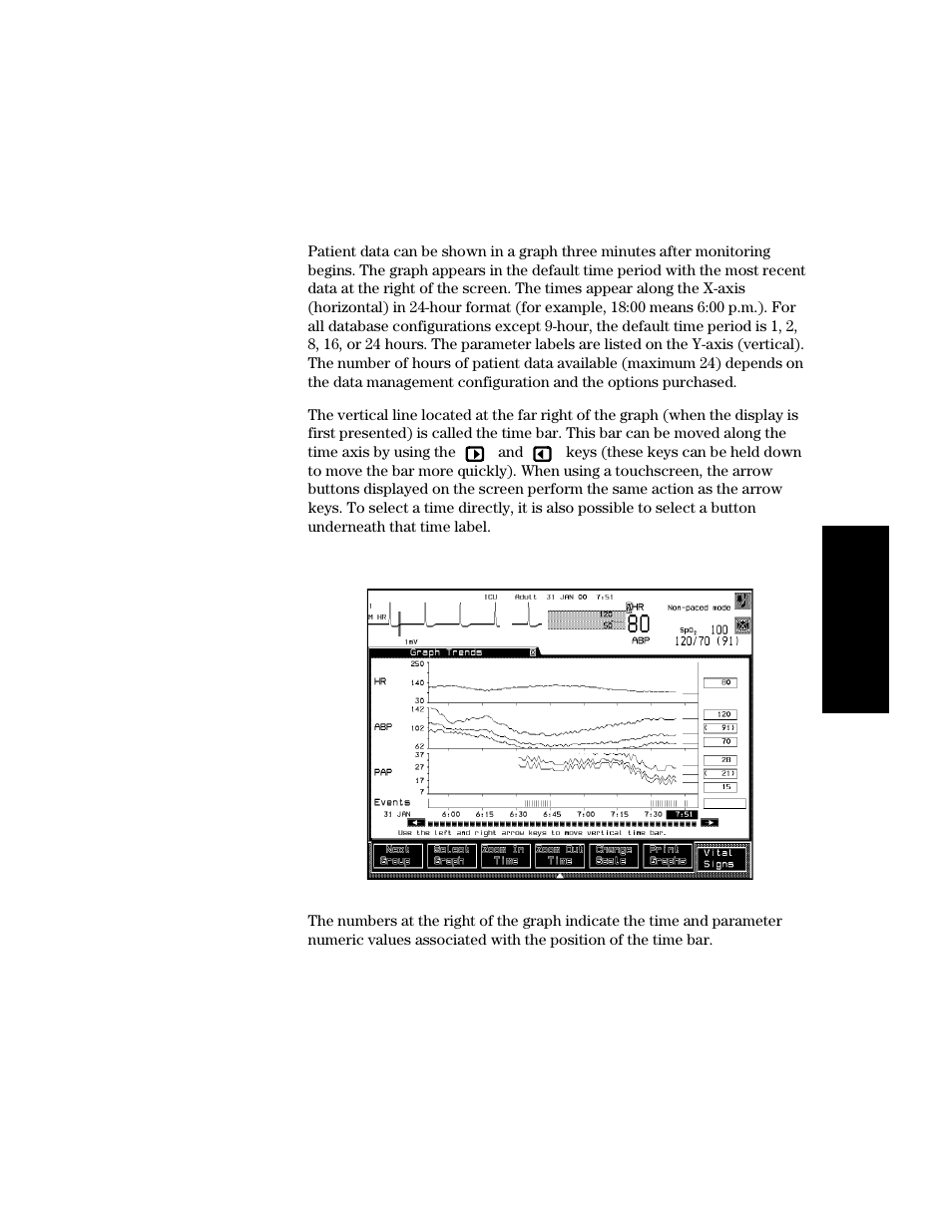 Viewing graph trends, Viewing graph trends -13 | Philips V24CT User Manual | Page 251 / 392