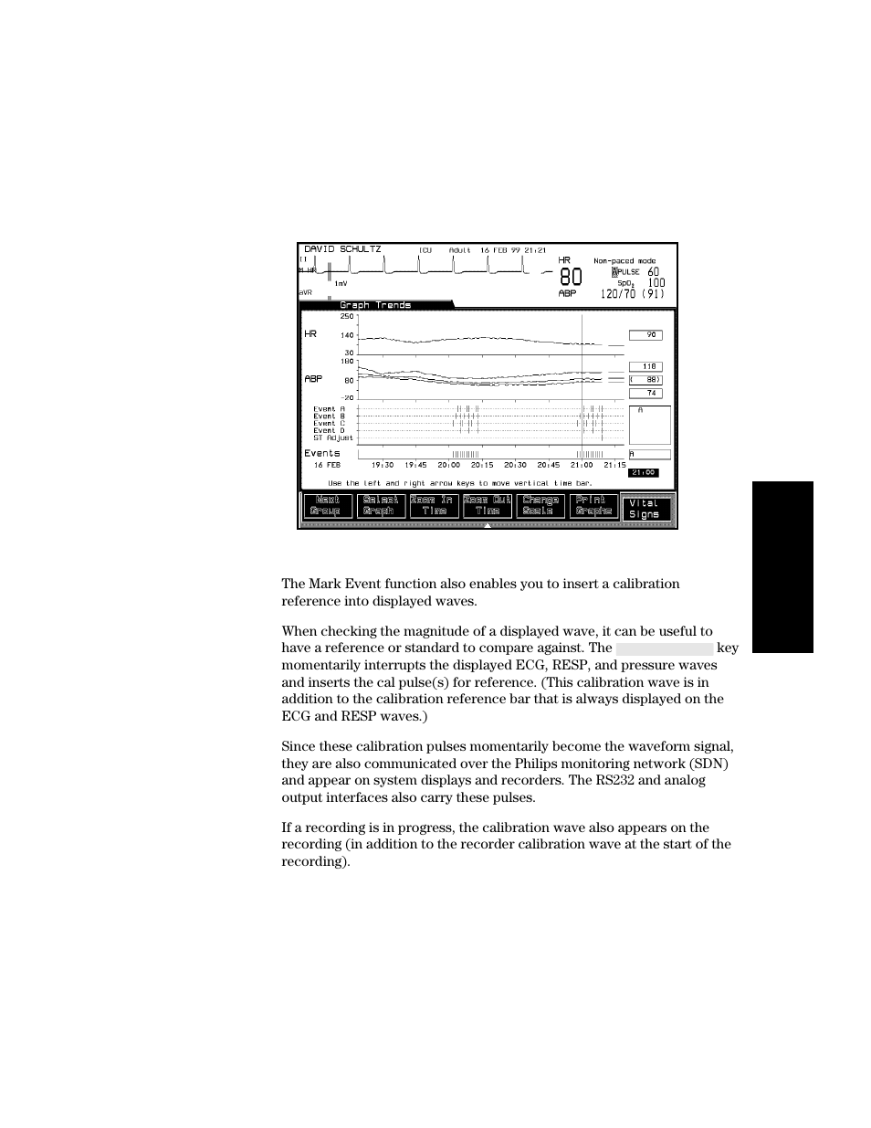 Philips V24CT User Manual | Page 255 / 392