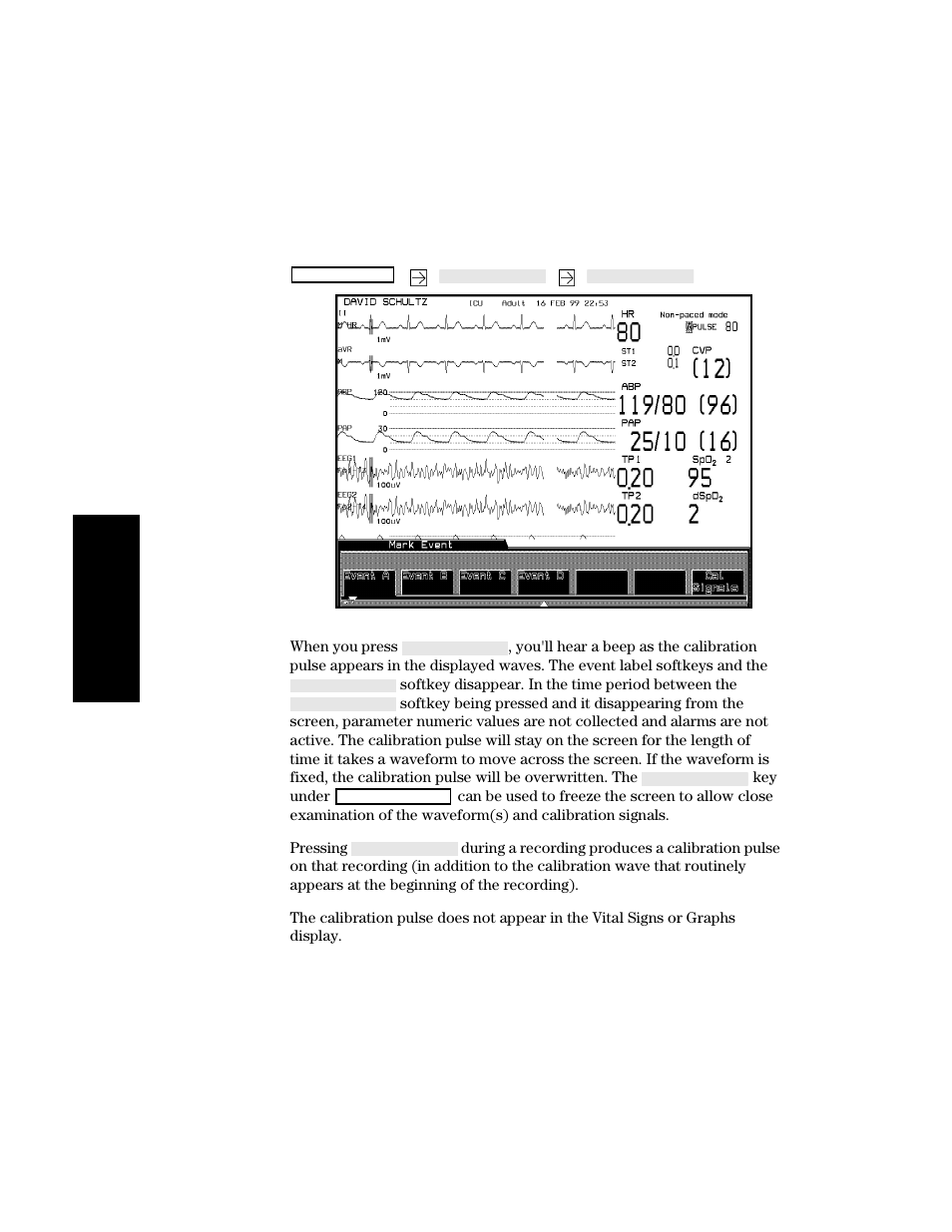 Philips V24CT User Manual | Page 256 / 392