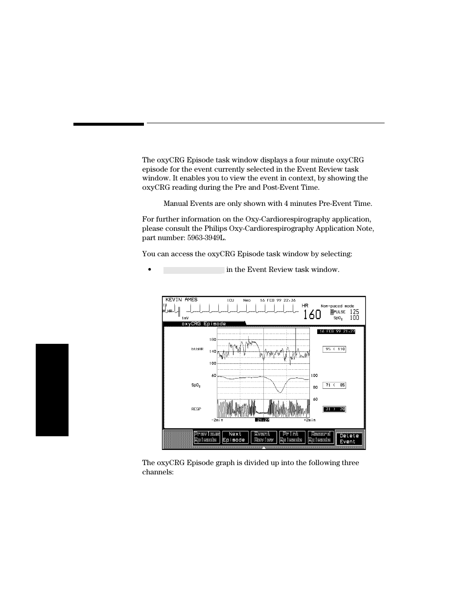 Viewing oxycrg episodes, Viewing oxycrg episodes -14 | Philips V24CT User Manual | Page 288 / 392