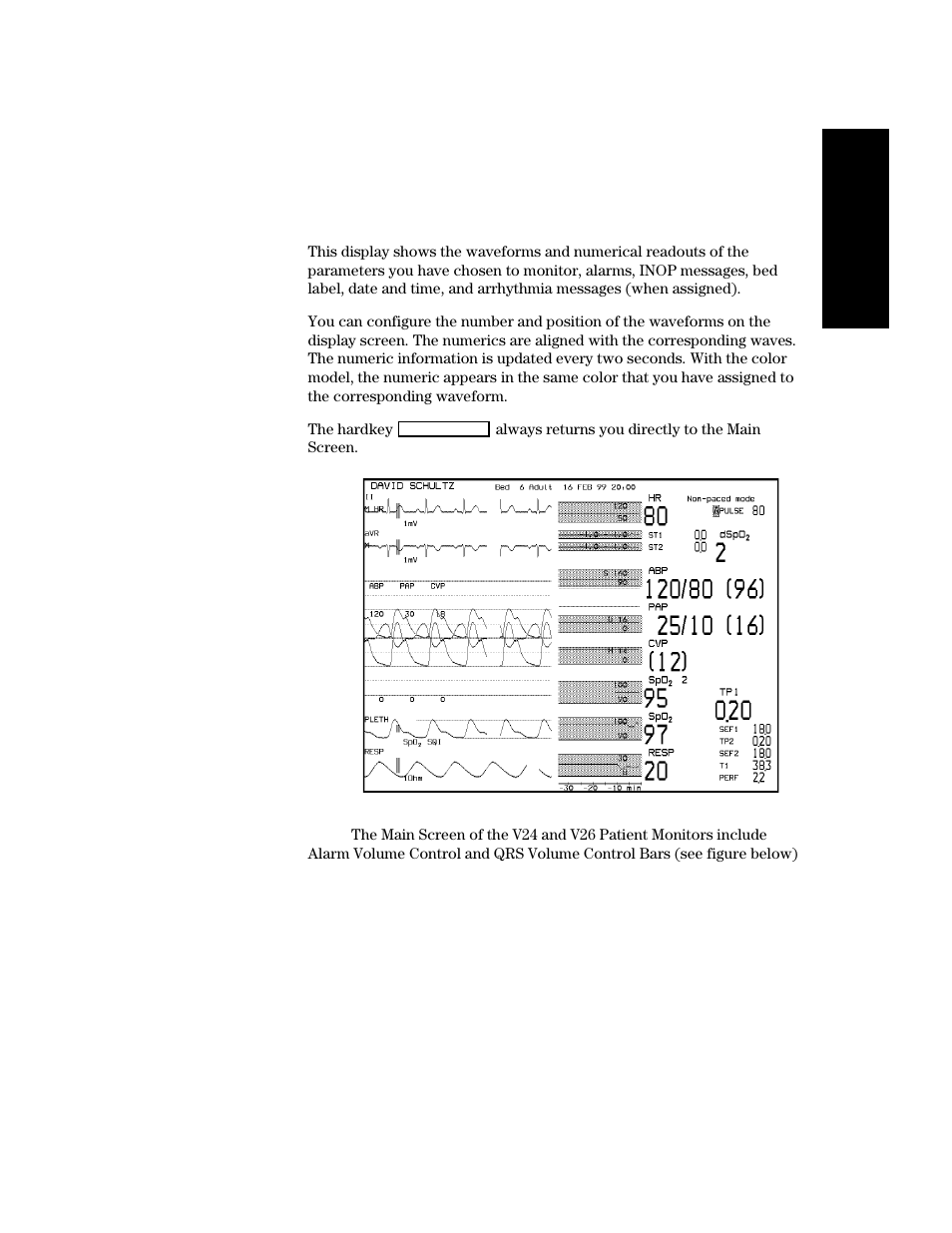 Main screen, Main screen -21 | Philips V24CT User Manual | Page 43 / 392