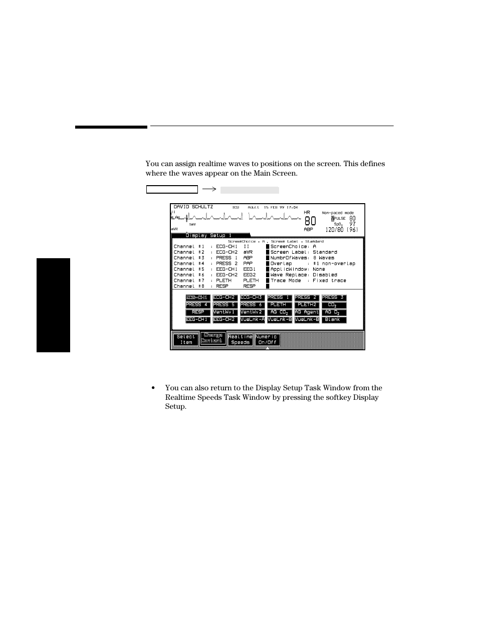 Assigning waves to screen channels, Assigning waves to screen channels -8 | Philips V24CT User Manual | Page 82 / 392