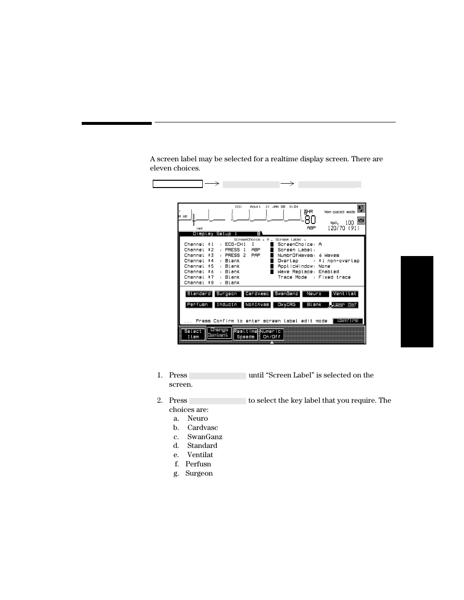 Procedure, Procedure -11 | Philips V24CT User Manual | Page 85 / 392