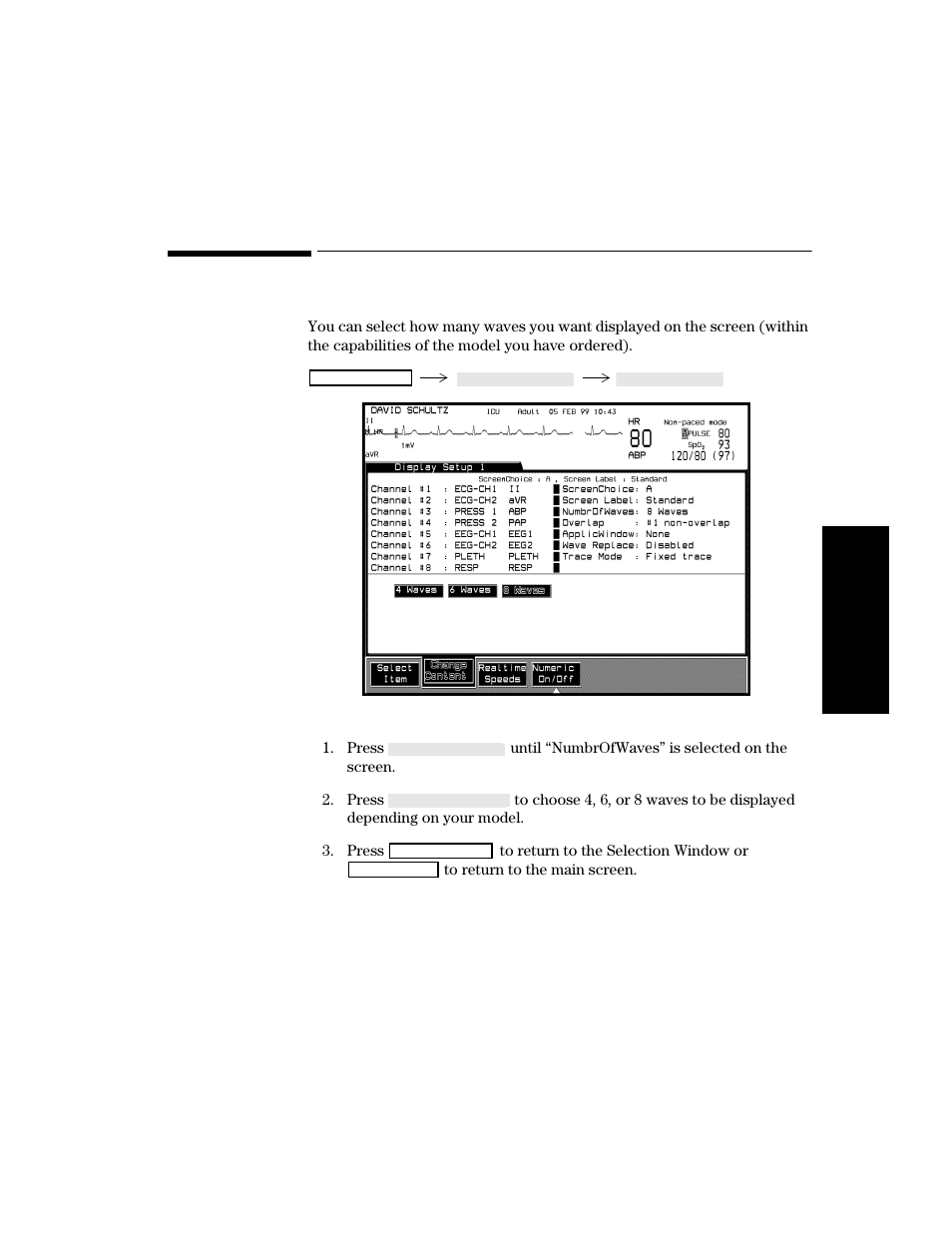 Selecting the number of waves, Procedure, Selecting the number of waves -13 | Procedure -13 | Philips V24CT User Manual | Page 87 / 392