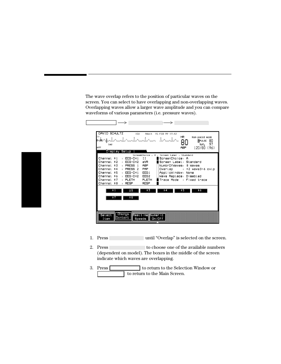 Changing the wave overlap, Procedure, Changing the wave overlap -14 | Procedure -14 | Philips V24CT User Manual | Page 88 / 392