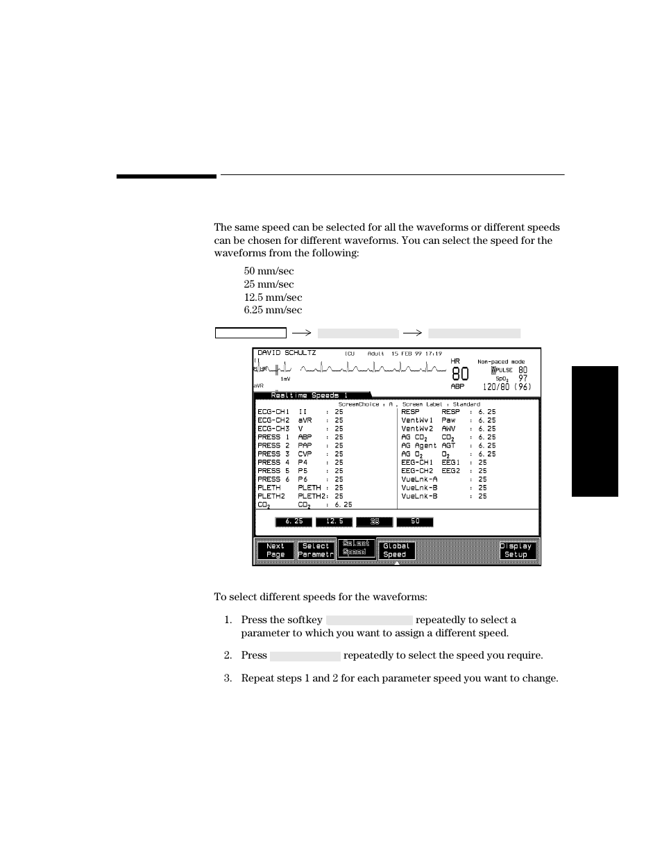 Selecting realtime wave speeds, Procedure, Selecting realtime wave speeds -15 | Procedure -15 | Philips V24CT User Manual | Page 89 / 392