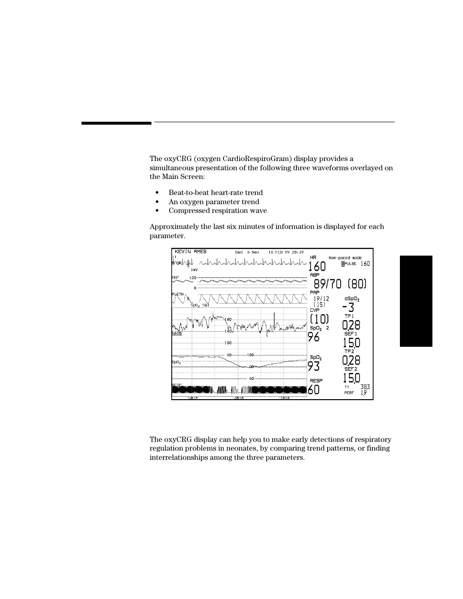 Oxycrg display, Oxycrg display -25 | Philips V24CT User Manual | Page 99 / 392
