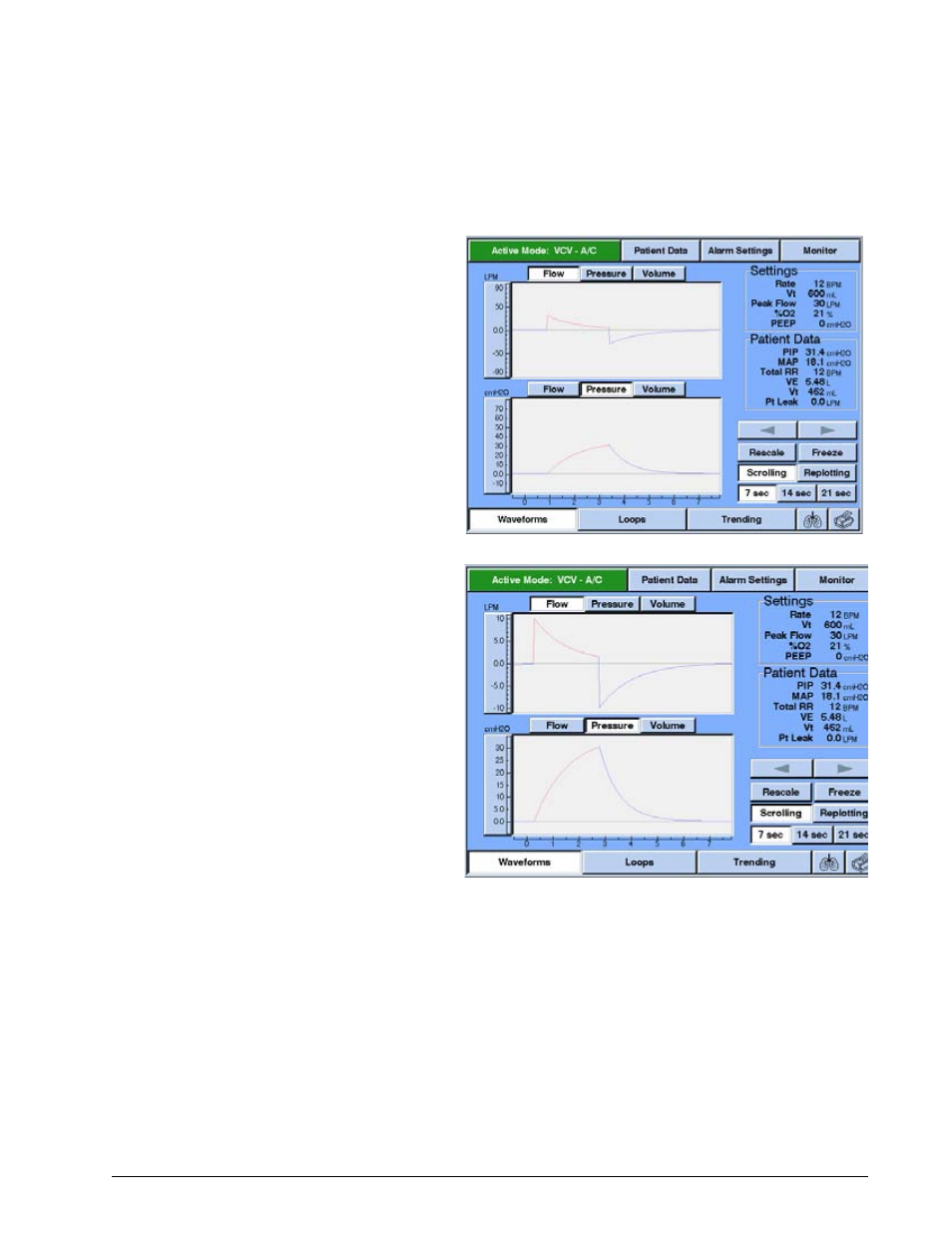 Options and accessories | Philips V200 User Manual | Page 185 / 328