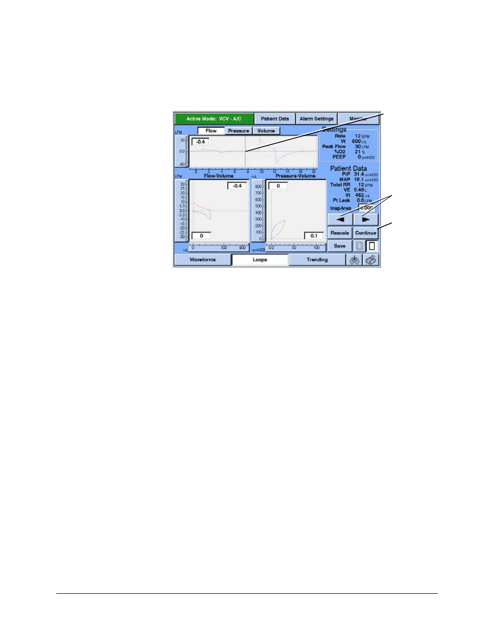 Save and overlay features, Save and overlay features -23, Options and accessories | Philips V200 User Manual | Page 187 / 328