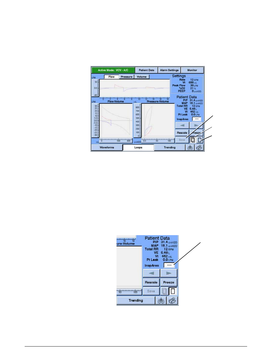 Inspiratory area, Inspiratory area -24, Options and accessories | Philips V200 User Manual | Page 188 / 328