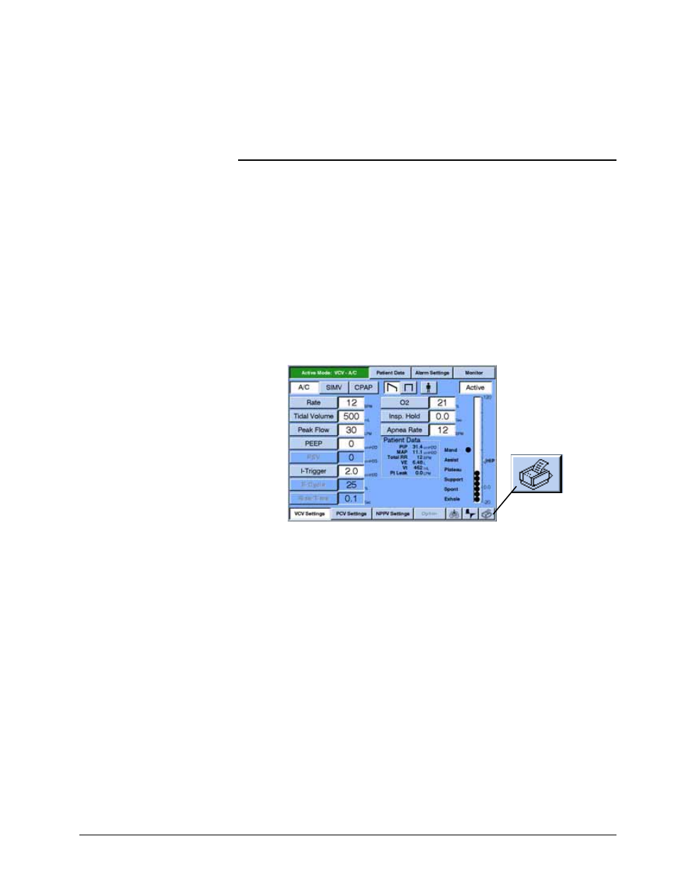 Print screen, Connecting to a printer, Communications option (com1) -27 print screen -27 | Communications option (com1) | Philips V200 User Manual | Page 191 / 328