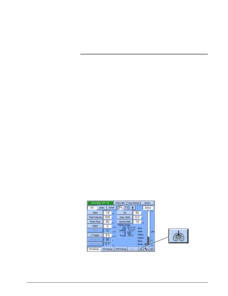 Accessing respiratory mechanics data, Respiratory mechanics option | Philips V200 User Manual | Page 215 / 328