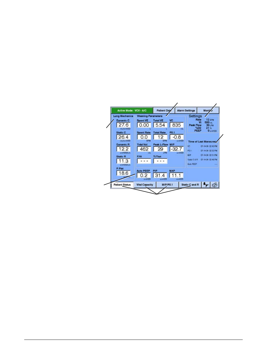 Vital capacity maneuver, Vital capacity maneuver -52, Options and accessories | Philips V200 User Manual | Page 216 / 328