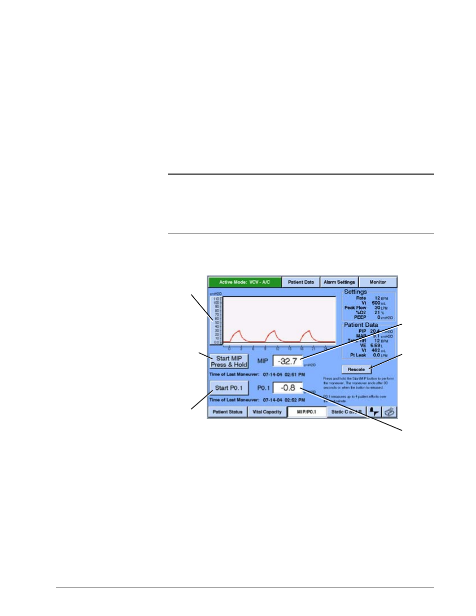 Options and accessories | Philips V200 User Manual | Page 219 / 328