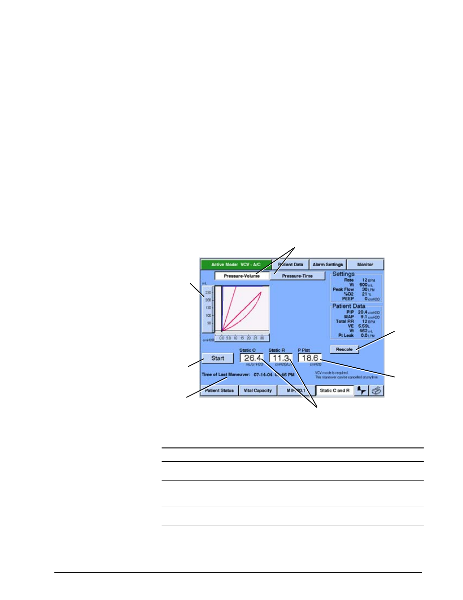 Options and accessories | Philips V200 User Manual | Page 221 / 328
