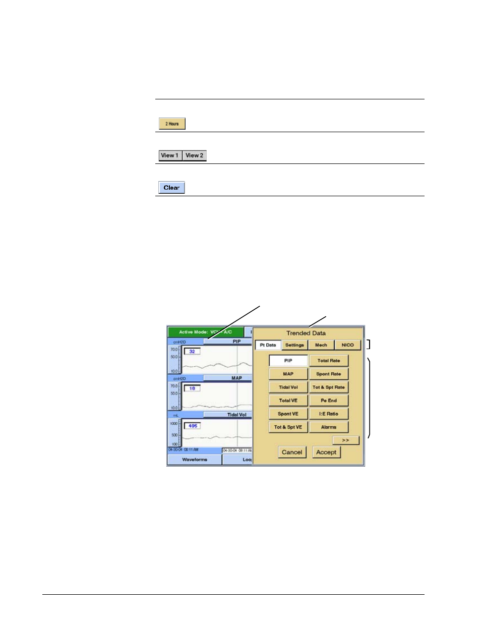 Selecting parameters for display, Selecting parameters for display -72, Options and accessories | Philips V200 User Manual | Page 236 / 328