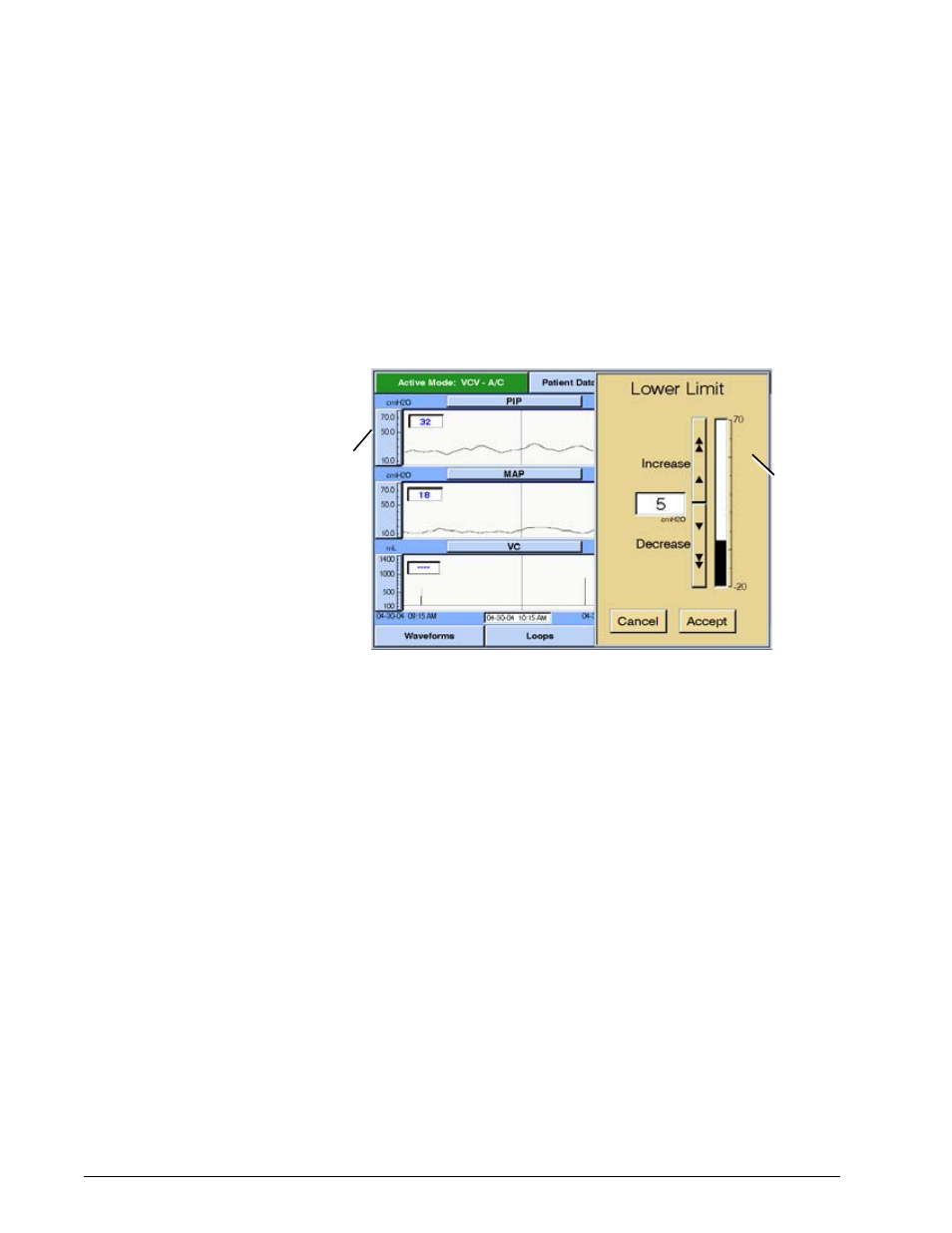 Using the manual rescale function, Changing the cursor position, Options and accessories | Philips V200 User Manual | Page 238 / 328