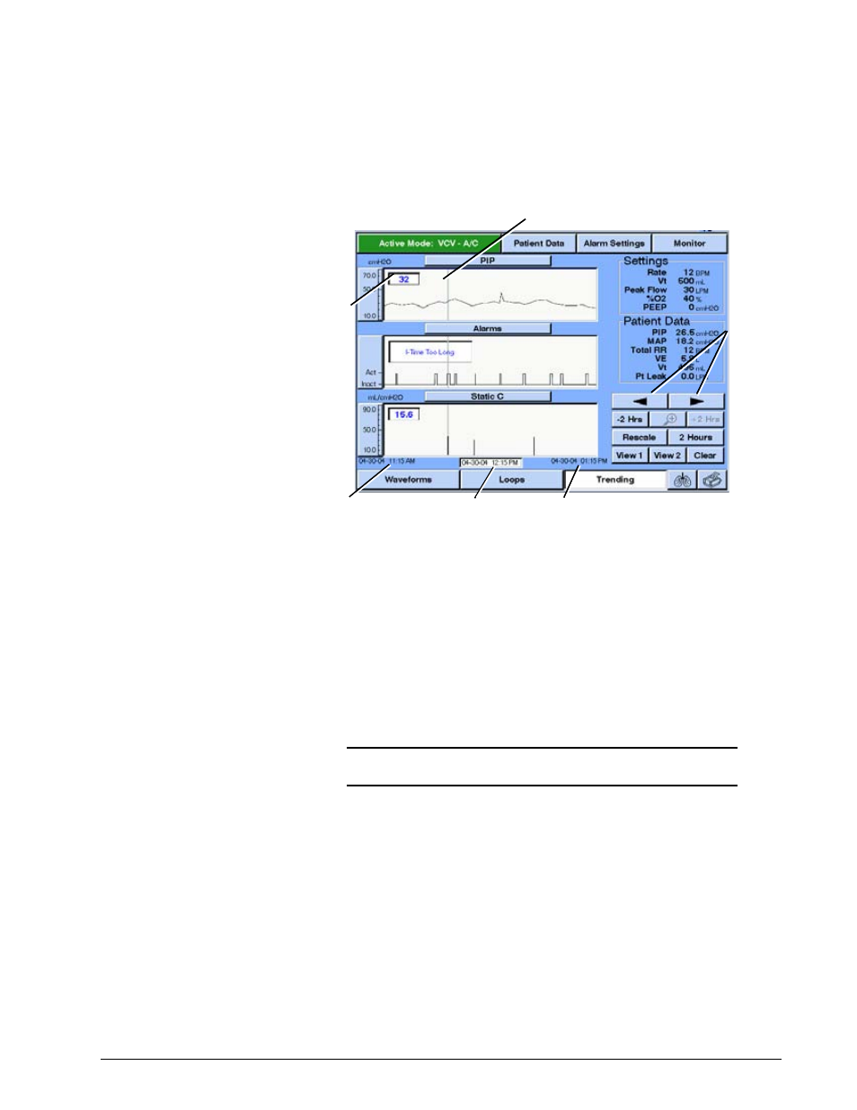 Selecting the time scale, Selecting the time scale -75, Options and accessories | Philips V200 User Manual | Page 239 / 328