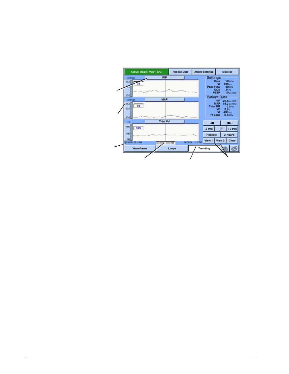 Options and accessories | Philips V200 User Manual | Page 258 / 328