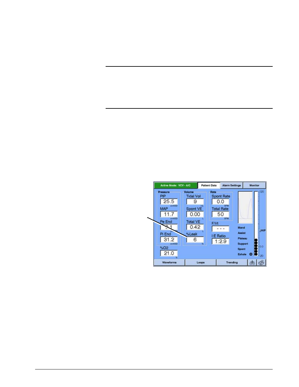 Percent leak, Percent leak -101, Options and accessories | Philips V200 User Manual | Page 265 / 328