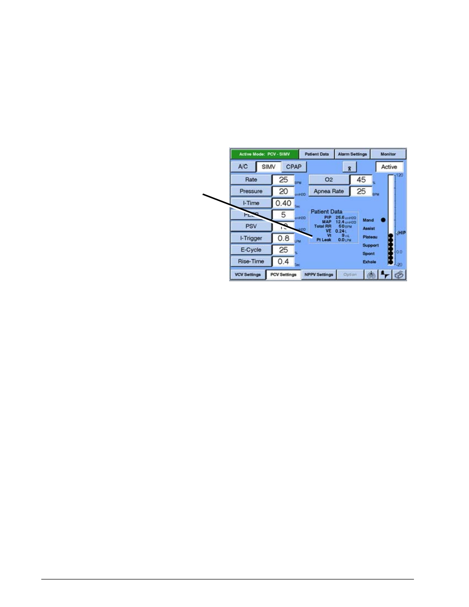 Patient leak values, Patient leak values -102, Options and accessories | Philips V200 User Manual | Page 266 / 328