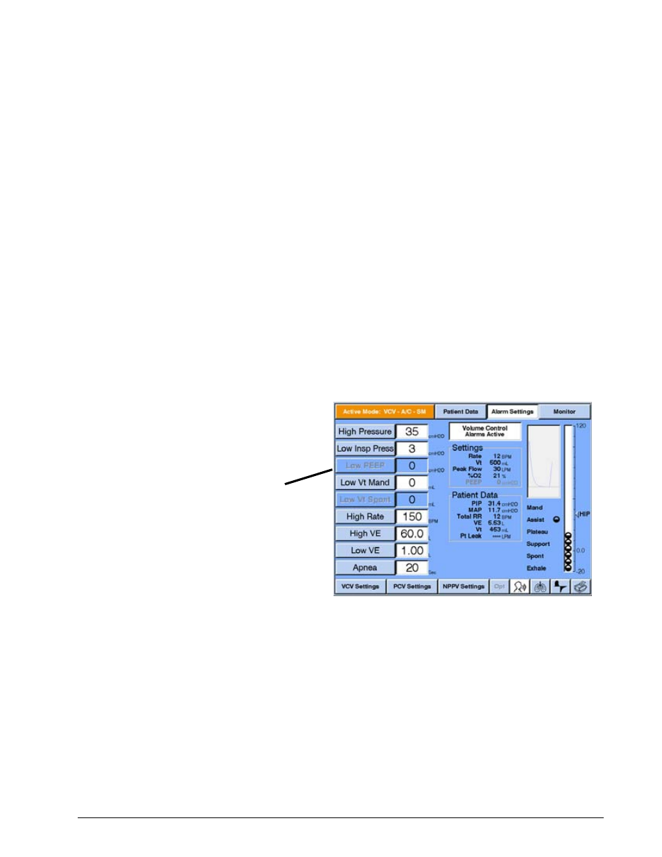 Alarms, Disabled alarms, Alarms -109 | Philips V200 User Manual | Page 273 / 328