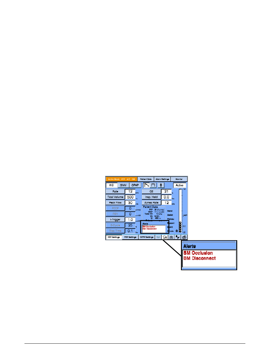 Mode-specific alarms, Options and accessories | Philips V200 User Manual | Page 274 / 328