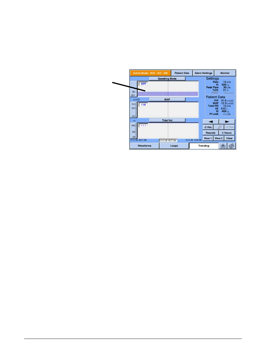 Options and accessories | Philips V200 User Manual | Page 278 / 328