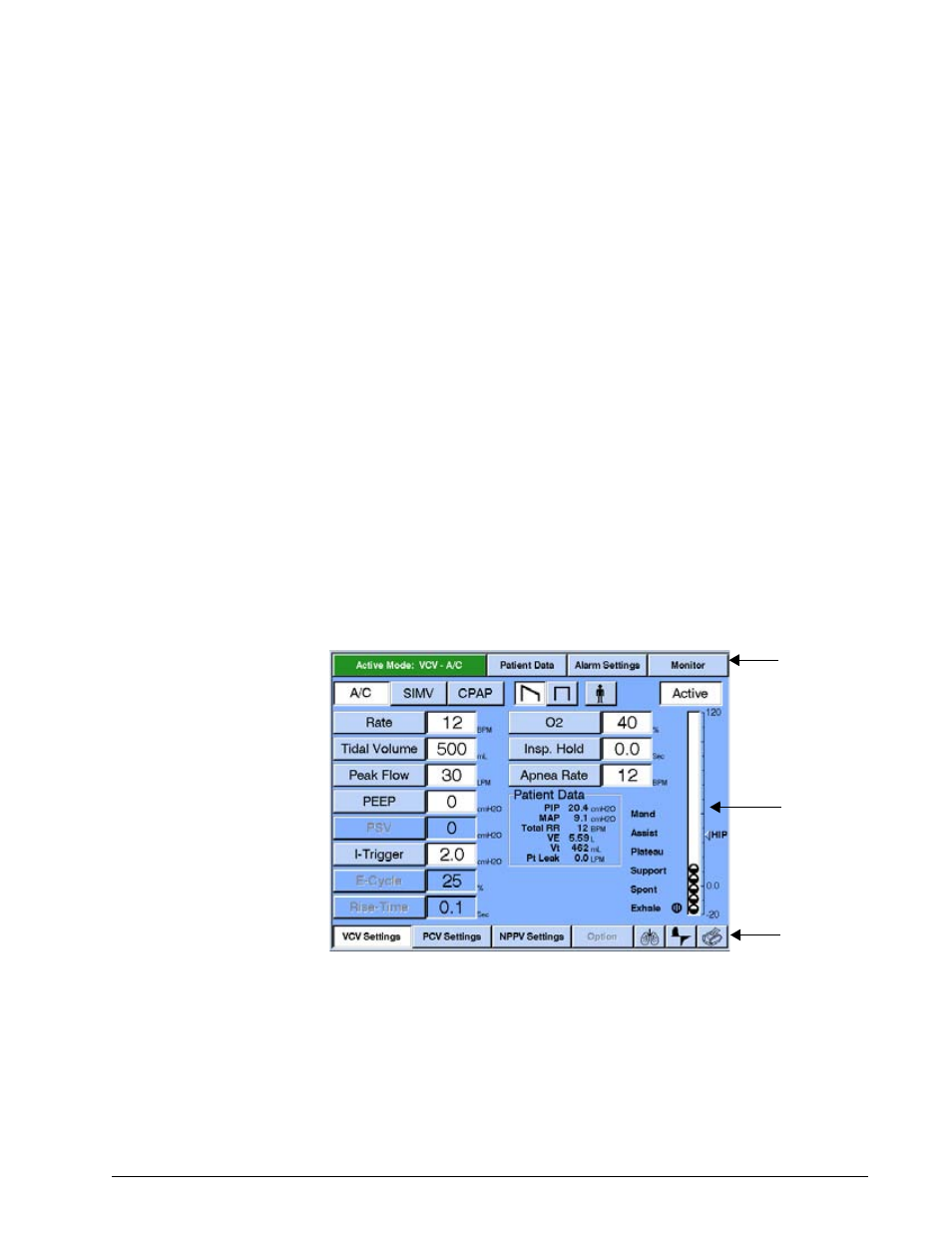 Ventilator screens, Front panel touch display, Common ventilator screen components | Ventilator screens -11 | Philips V200 User Manual | Page 89 / 328