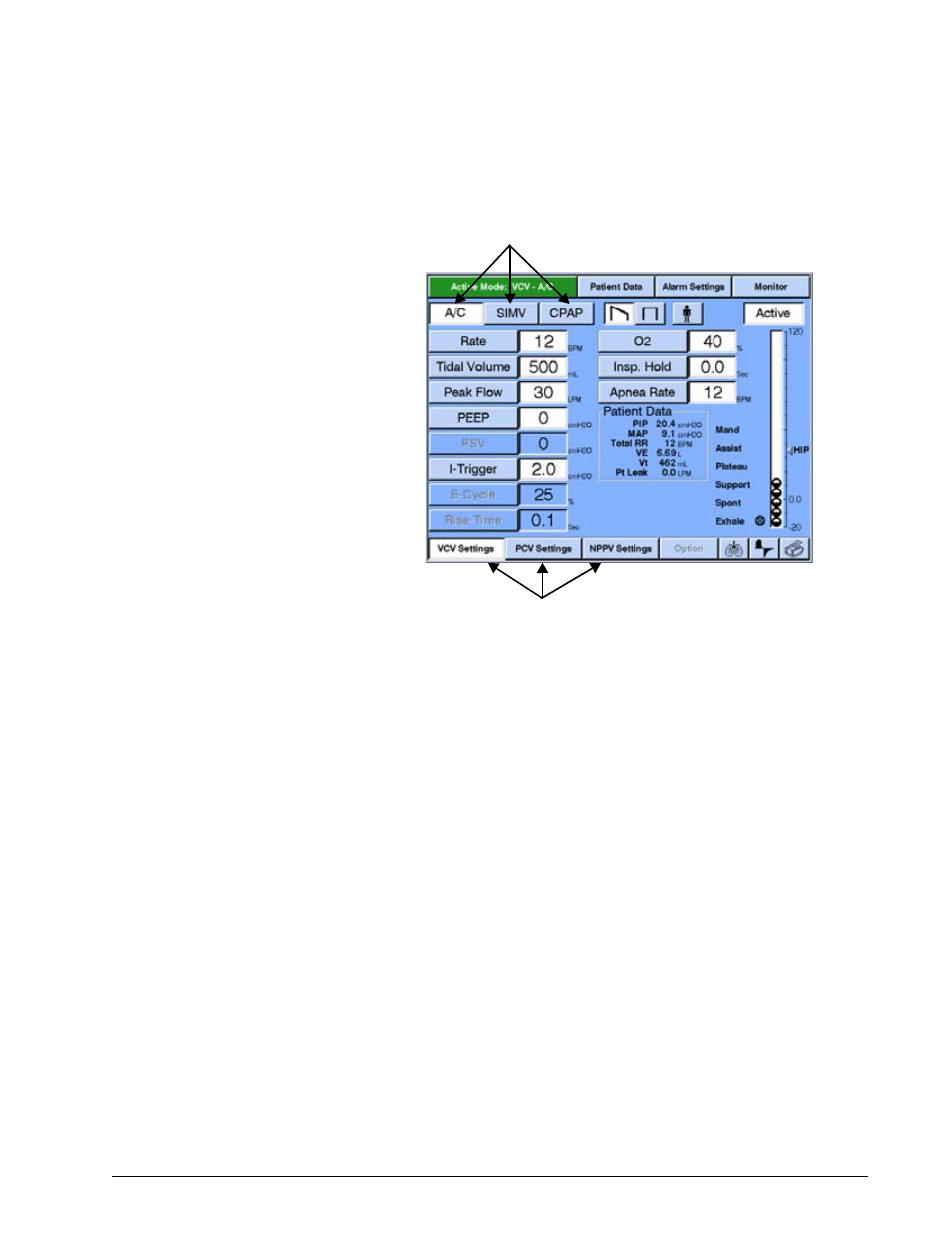 Selecting settings, Figure 8-13), Figure 8-13 | Grayed out. in figure 8-13, Operating instructions | Philips V200 User Manual | Page 93 / 328