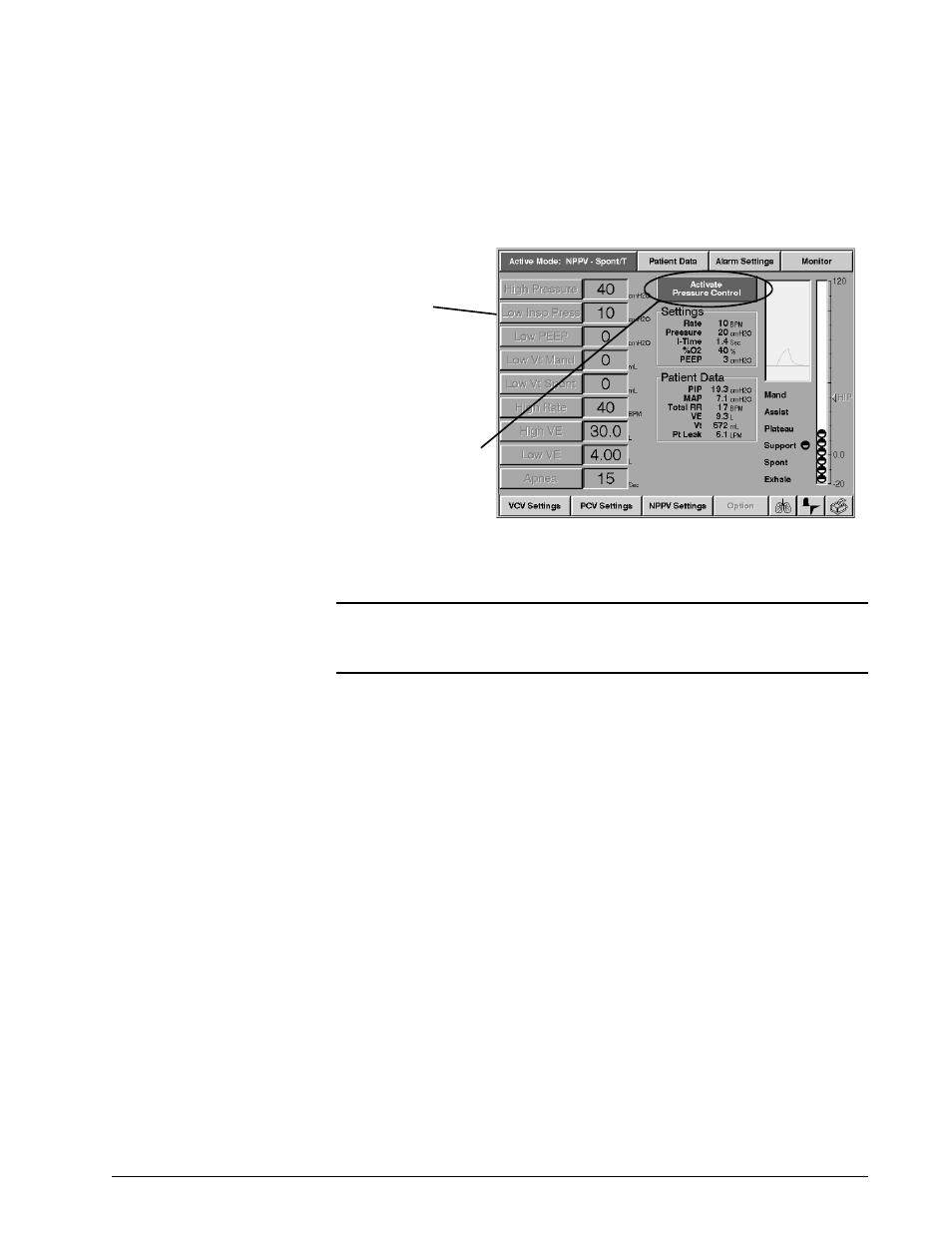 Selecting waveforms (vcv only), V (figure 8-18), S (figure 8-18) are grayed out | Operating instructions | Philips V200 User Manual | Page 97 / 328