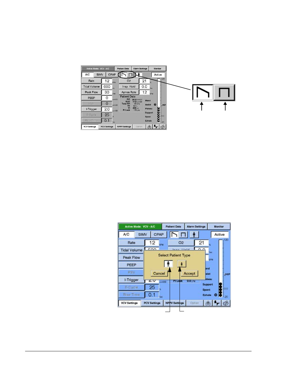 Selecting adult/pediatric buttons, Operating instructions | Philips V200 User Manual | Page 98 / 328