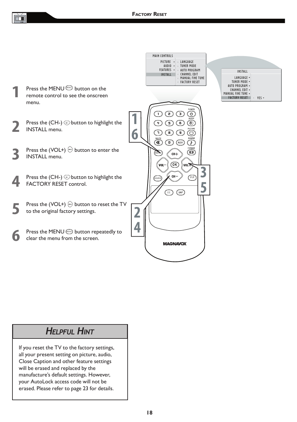 Philips 15MF/20MF User Manual | Page 18 / 39