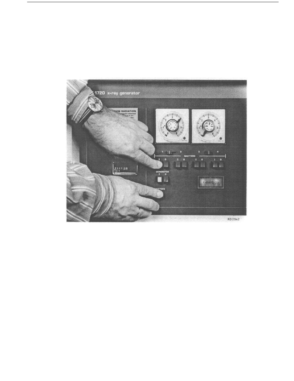 Philips PW 1720 User Manual | Page 3 / 8