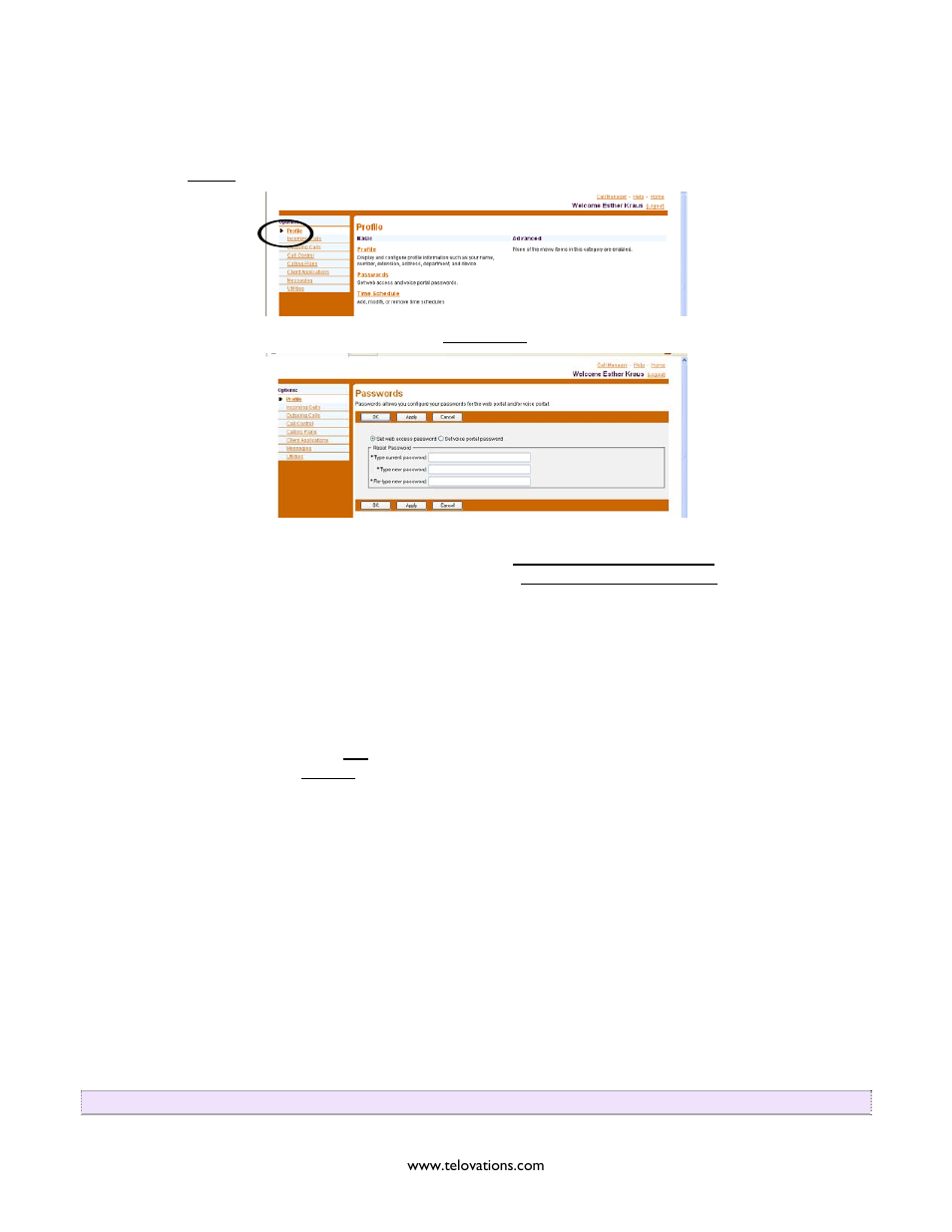 Orwarding, Lways | Polycom Telovations 7941 User Manual | Page 20 / 26