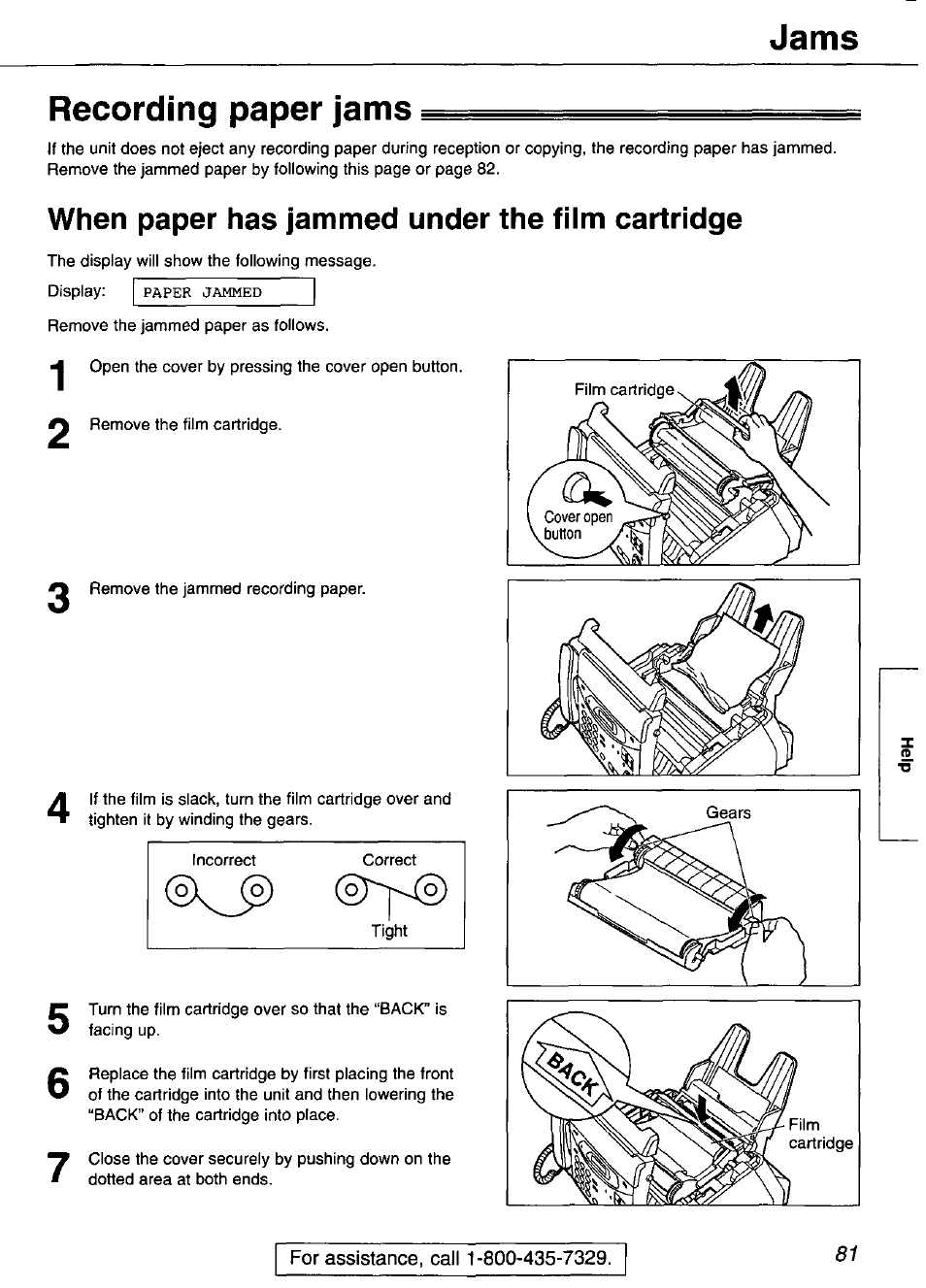 Recording paper jams, When paper has jammed under the film cartridge, Jams | Panasonic KX-FP101 User Manual | Page 81 / 104