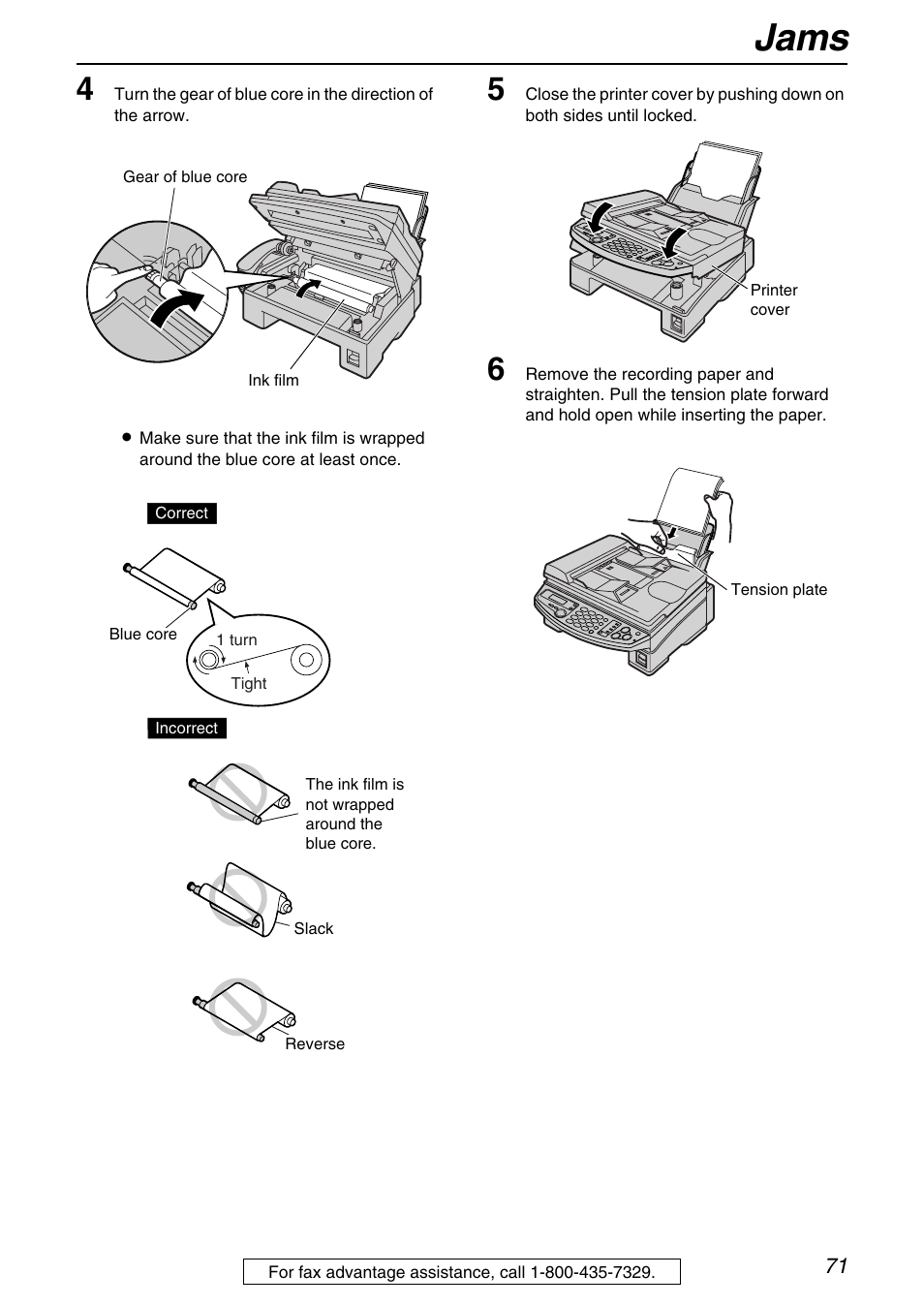 Jams | Panasonic KX-FB421 User Manual | Page 71 / 92