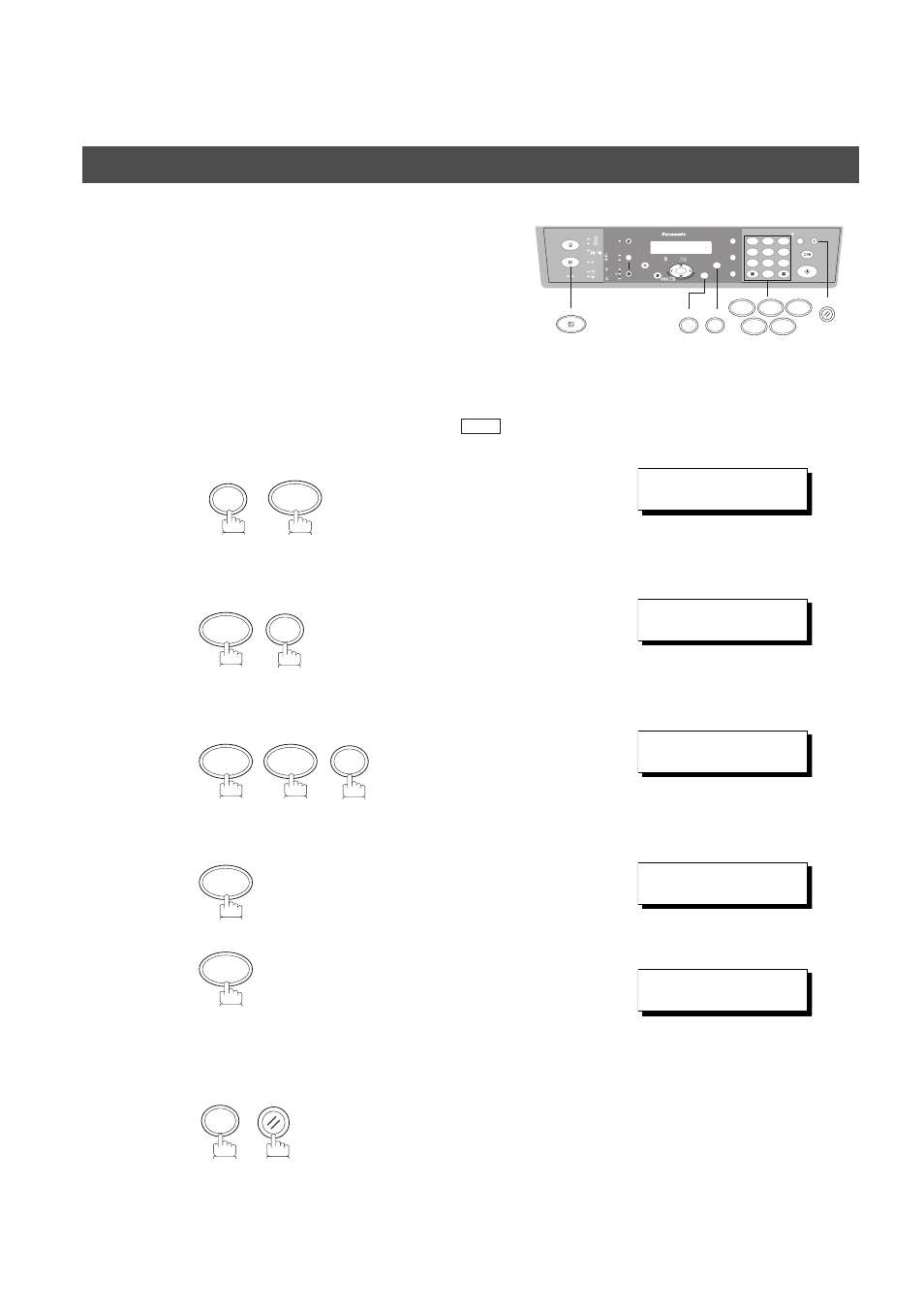 Pin code access, Selecting the access method (prefix or suffix), Network feature | Panasonic DP-150FX User Manual | Page 72 / 112