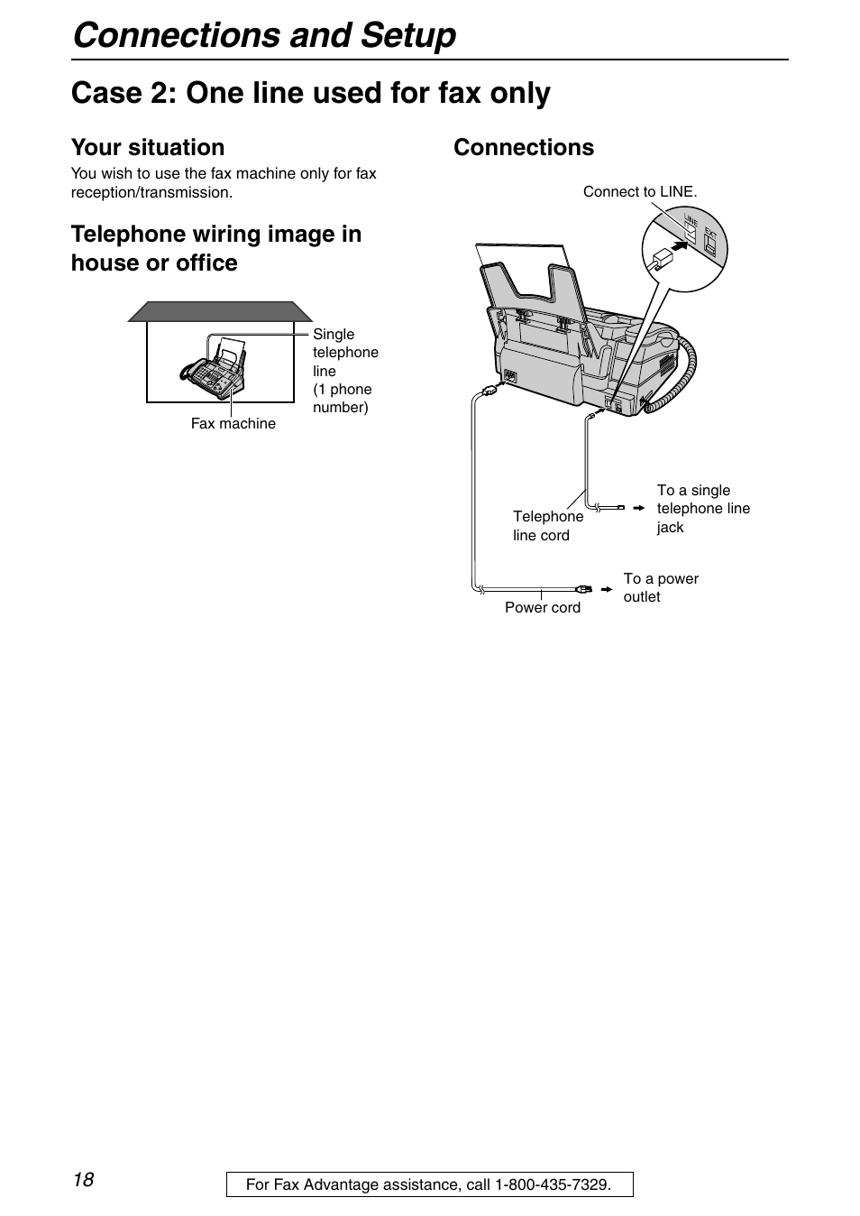Connections and setup, Case 2: one line used for fax only, Your situation | Panasonic KX-FHD332 User Manual | Page 18 / 92