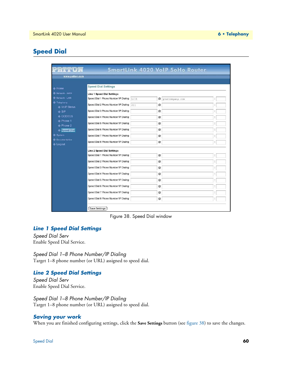 Speed dial, Line 1 speed dial settings, Speed dial serv | Speed dial 1-8 phone number/ip dialing, Line 2 speed dial settings, Saving your work, Speed dial 1–8 phone number/ip dialing, Speed dial window | Patton electronic SL4020 User Manual | Page 60 / 97