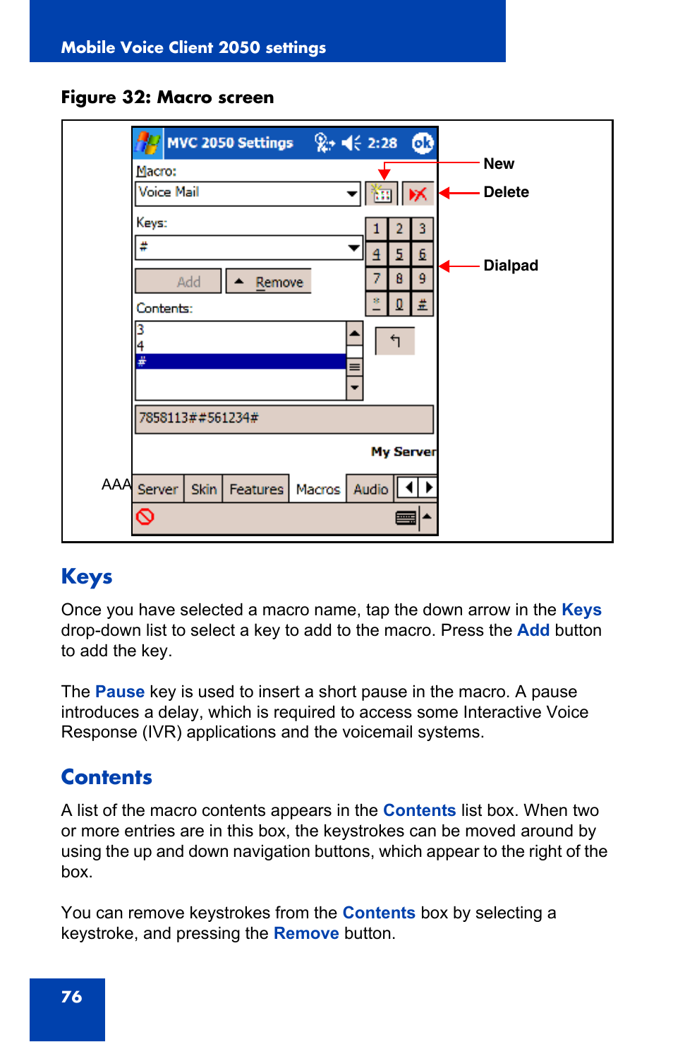 Nortel Networks N0035509 User Manual | Page 76 / 90