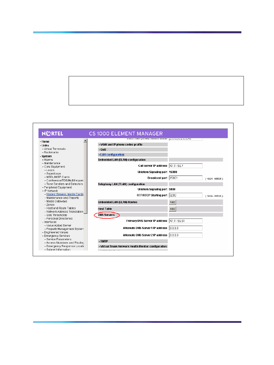 Sip trunk configuration, Figure 56 dns configuration, Attention | Nortel Networks NN43001-121 User Manual | Page 160 / 304