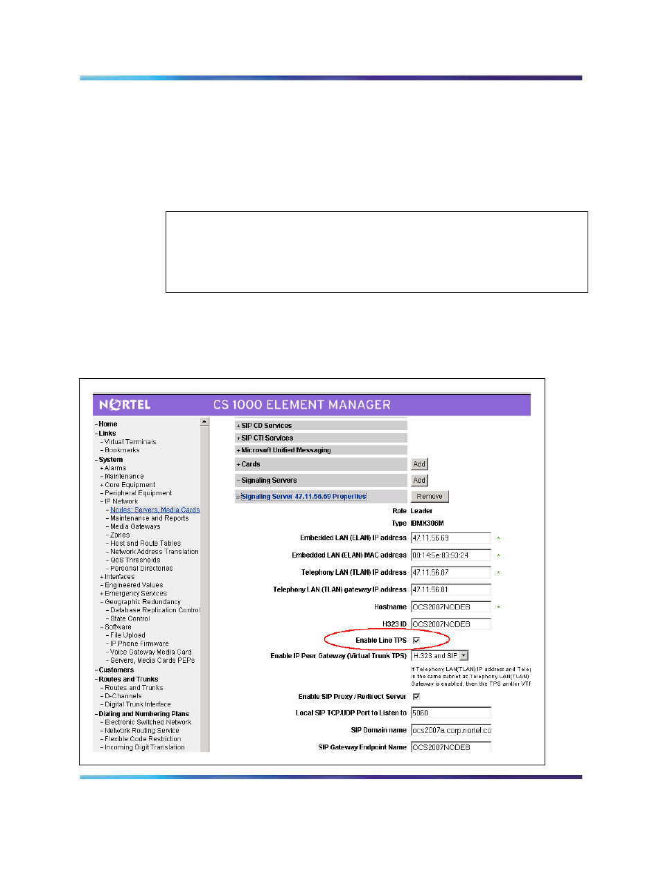 Figure 65 tr/87 node configuration, Node parameter configuration, Attention | Nortel Networks NN43001-121 User Manual | Page 178 / 304