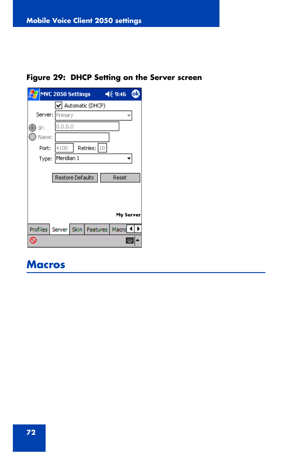 Figure 29: dhcp setting on the server screen, Macros, Mobile voice client 2050 settings | Nortel Networks NN42340-100 User Manual | Page 72 / 88