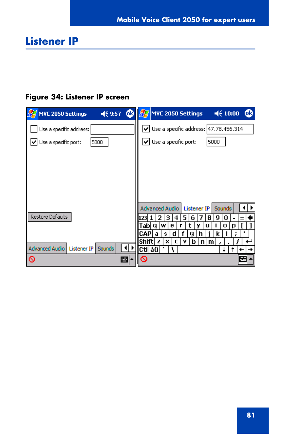 Listener ip | Nortel Networks NN42340-100 User Manual | Page 81 / 88