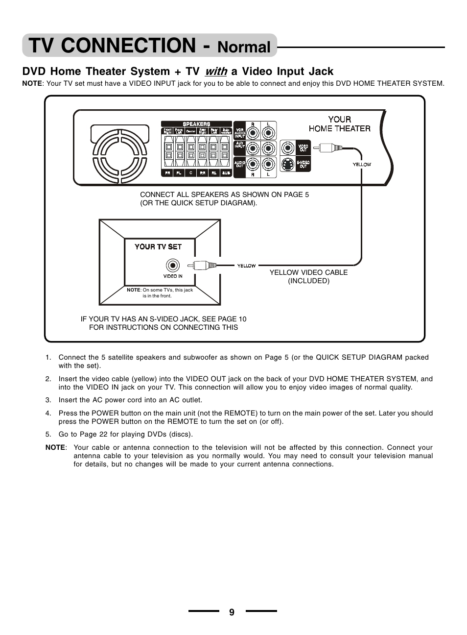 Tv connection, Normal | Regent Sheffield HT- 5OO User Manual | Page 10 / 12