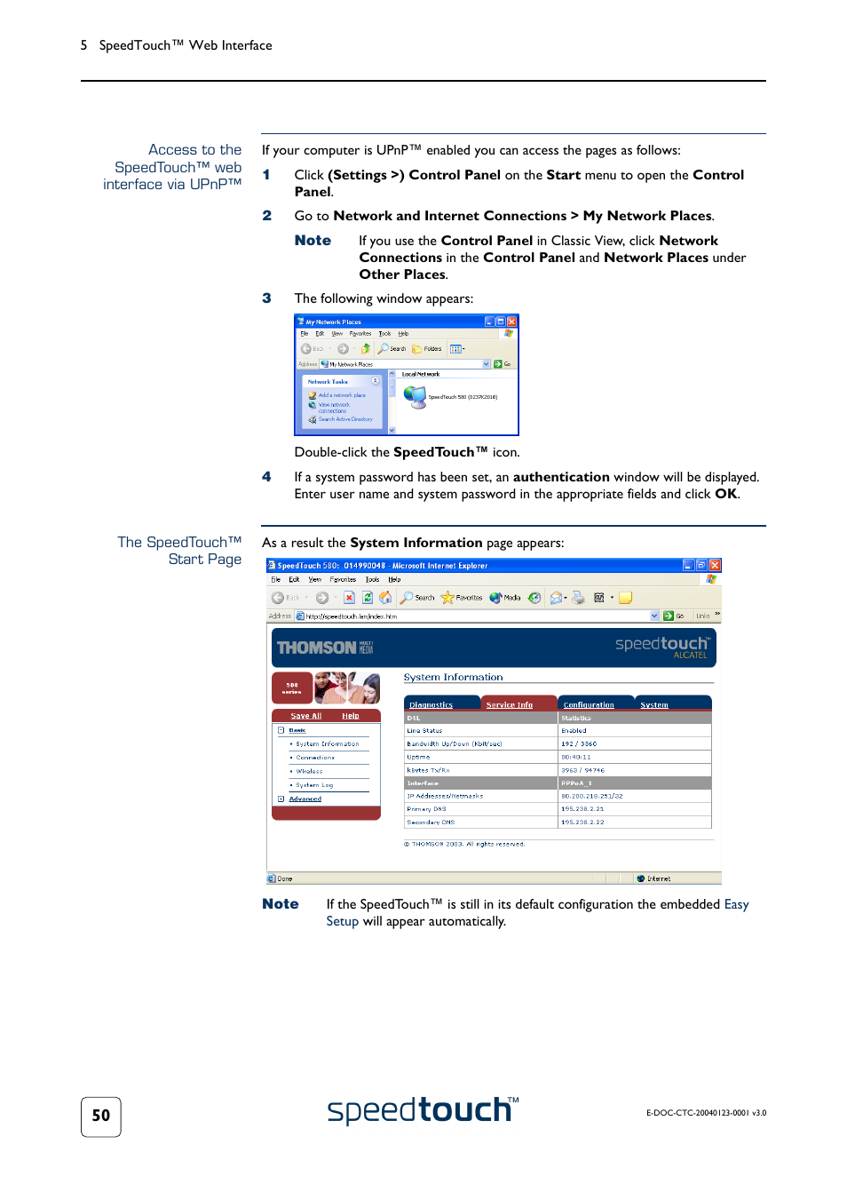 Access to the speedtouch™ web interface via upnp | RCA 580 User Manual | Page 52 / 104
