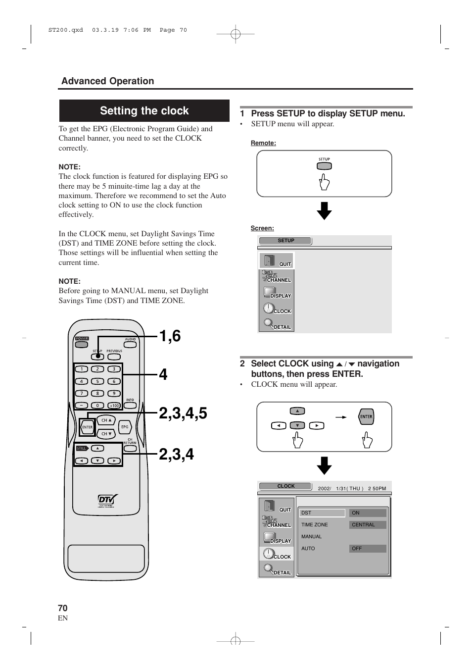 Setting the clock, Advanced operation | Sylvania SRZ3000 User Manual | Page 70 / 108