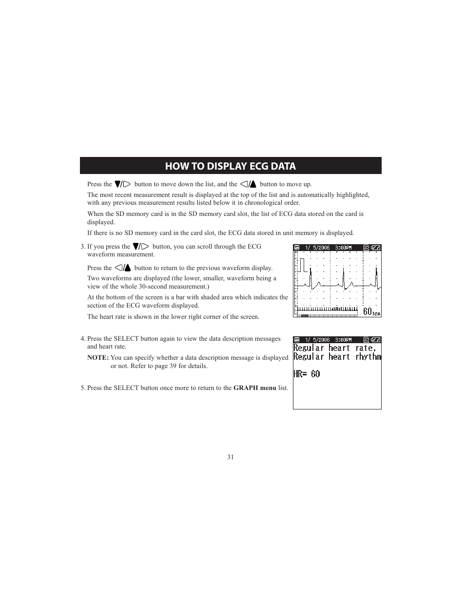 How to display ecg data | Omron HCG-801 User Manual | Page 31 / 128